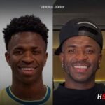 😏Vinicius Jr cède à la chirurgie esthétique et change visage